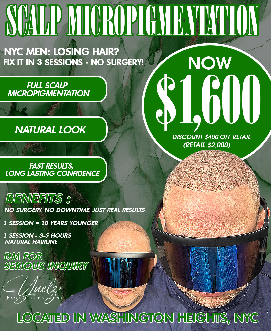 Scalp Micropigmentation Offer